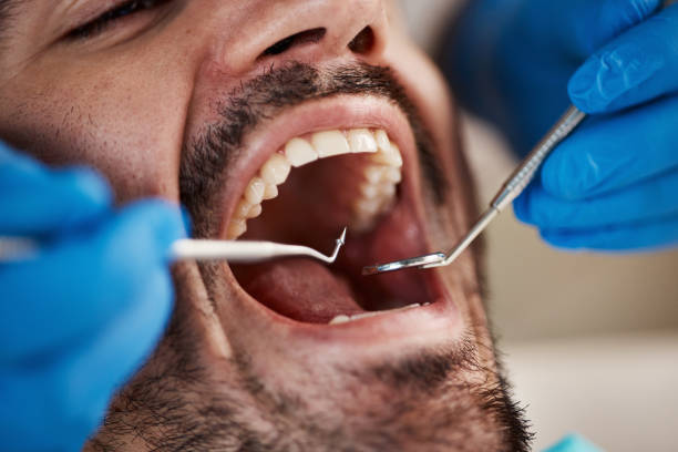 Best Emergency Root Canal Treatment in Logan, OH