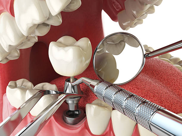 Logan, OH Emergency Dentist Pros